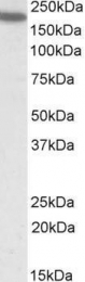 GTX88390 - CD11a / ITGAL