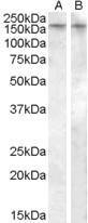 GTX88634 - Vasopressin V1b receptor (V1bR)