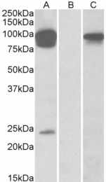GTX88648 - TRPV3 / Vanilloid receptor-like 3