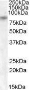 GTX88774 - TRPV5 / ECAC1