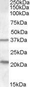 GTX88807 - TUSC3 / N33