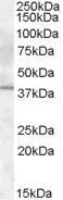 GTX88847 - Interleukin-12 beta / IL12B