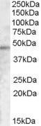 GTX88931 - TMPRSS3