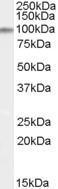 GTX88991 - ITCH / AIF4