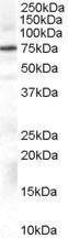 GTX89353 - Beta-ARK-1 / ADRBK1