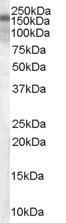 GTX89366 - TSC1 / Hamartin