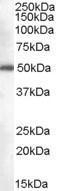 GTX89391 - DDX6