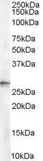 GTX89431 - 14-3-3 protein sigma / SFN