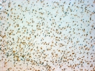 GTX89459 - Tryptophan 5-hydroxylase 2 (TPH2)