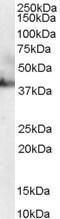 GTX89517 - RAE1