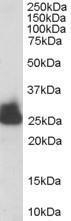 GTX89594 - Triosephosphate isomerase (TPI1)