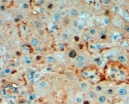 GTX89594 - Triosephosphate isomerase (TPI1)