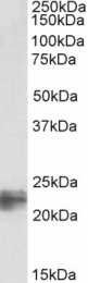 GTX89789 - Transgelin (TAGLN)