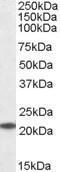 GTX89819 - UBE2T