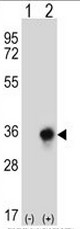 AP50744PU-N - Carbonyl reductase 3