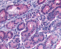 Fig. 1: <span>Immunohistochemical staining of Nasal mucosa section using anti-BDKRB1 antibody SP4076P (Formalin-Fixed Paraffin Embedded).</span>