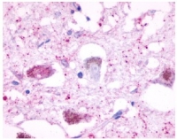  Immunohistochemical staining of brain (neurons and glia) using antibody SP4048P (Formalin-Fixed Paraffin Embedded).