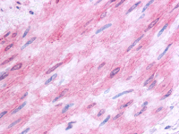 Immunohistochemical staining of Vascular smooth muscle using anti-HTR1B antibody SP4041P.