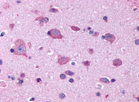  Immunohistochemical staining of Brain (Neurons and Glia) using anti-HTR2B antibody SP4046P.