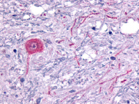 Immunohistochemical staining of Brain (Neuron) using anti- HTR6 antibody SP4049P