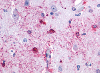 Immunohistochemical staining of Brain (Neurons and Astrocytes) using anti- HTR7 antibody SP4050P