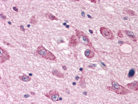 Immunohistochemical staining of Brain (neurons and glia) using anti- HTR7 antibody SP4051P
