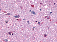 Fig. 1: <span>Immunohistochemical staining of Brain using anti- MCHR1 antibody SP4317P.</span>