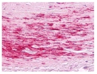 Fig. 2: <span>Artery, atherosclerosis, tunica media: Formalin-Fixed Paraffin-Embedded (FFPE)</span>