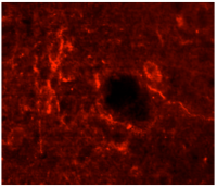 Fig. 3: <span>Immunofluorescent detection of Bradykinin R2 in Rat brain using Cy3 conjugated anti-rabbit secondary antibodies (red fluorescence).</span>