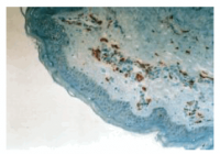 Frozen skin section (DAB)