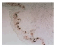 Human skin frozen section: Langerhans cells staining with 808E10.01-HRP